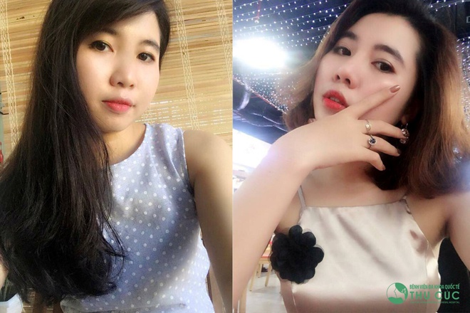 Chỉ cần thay đổi dáng mũi thôi là chúng ta ai cũng có thể trở nên xinh đẹp hơn mà!  - Ảnh 1.