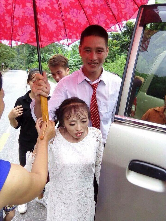 Bị gia đ&igrave;nh ngăn cản v&igrave; c&ocirc; d&acirc;u thấp c&ograve;i suy dinh dưỡng, ch&uacute; rể Lạng Sơn vẫn quyết về chung 1 nh&agrave; - Ảnh 3.