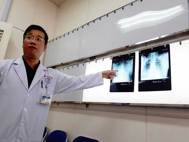 Thực hư virus lạ g&acirc;y chết người  - Ảnh 1.