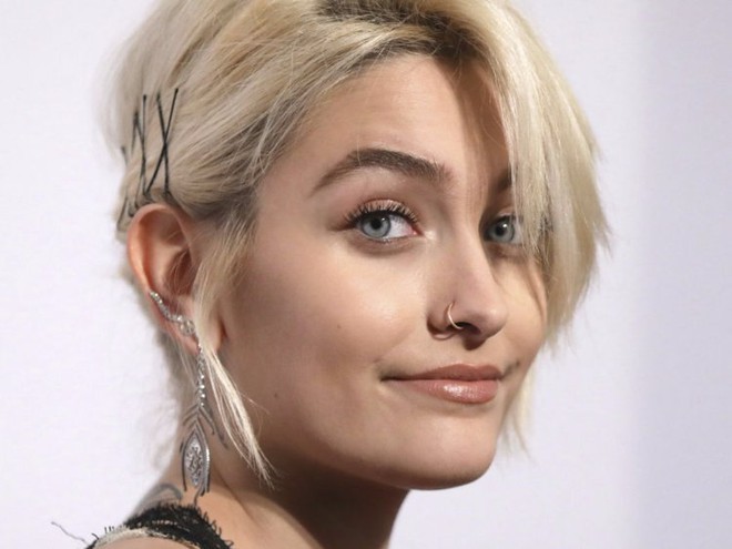 Ít ai biết, màu mắt xanh trong veo hút hồn của Paris Jackson thực chất là ảnh hưởng từ một căn bệnh hiếm - Ảnh 3.