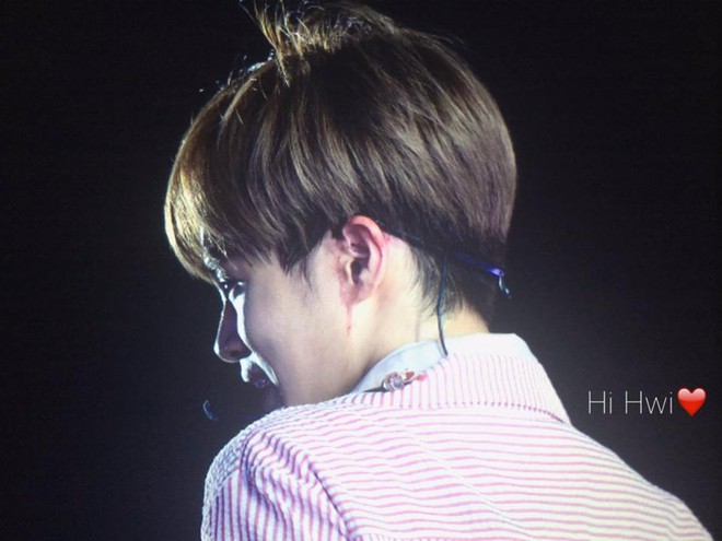 Th&agrave;nh vi&ecirc;n Wanna One chảy m&aacute;u tai r&ograve;ng r&ograve;ng trong l&uacute;c biểu diễn - Ảnh 1.