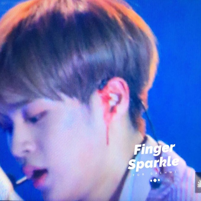 Th&agrave;nh vi&ecirc;n Wanna One chảy m&aacute;u tai r&ograve;ng r&ograve;ng trong l&uacute;c biểu diễn - Ảnh 2.