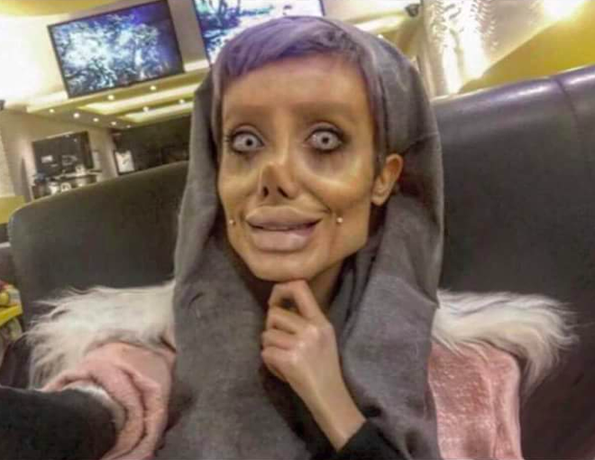Bị d&acirc;n t&igrave;nh n&eacute;m đ&aacute; dữ dội, c&ocirc; g&aacute;i phẫu thuật giống Angelina Jolie ch&iacute;nh thức l&ecirc;n tiếng phản ph&aacute;o - Ảnh 1.