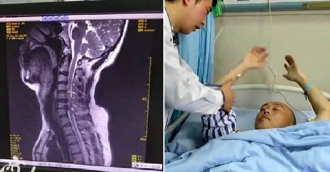 Thanh ni&ecirc;n Trung Quốc bị liệt v&igrave; chơi game tr&ecirc;n điện thoại 2 ng&agrave;y r&ograve;ng - Ảnh 2.