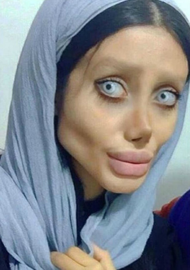 Bị d&acirc;n t&igrave;nh n&eacute;m đ&aacute; dữ dội, c&ocirc; g&aacute;i phẫu thuật giống Angelina Jolie ch&iacute;nh thức l&ecirc;n tiếng phản ph&aacute;o - Ảnh 6.