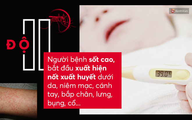 Dịch sốt xuất huyết đang ở ngay cạnh rồi: cần biết ngay các triệu chứng để phát hiện và chữa kịp thời - Ảnh 2.