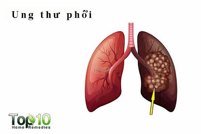 Tác hại kinh hoàng của khói thuốc lá - Ảnh 2.