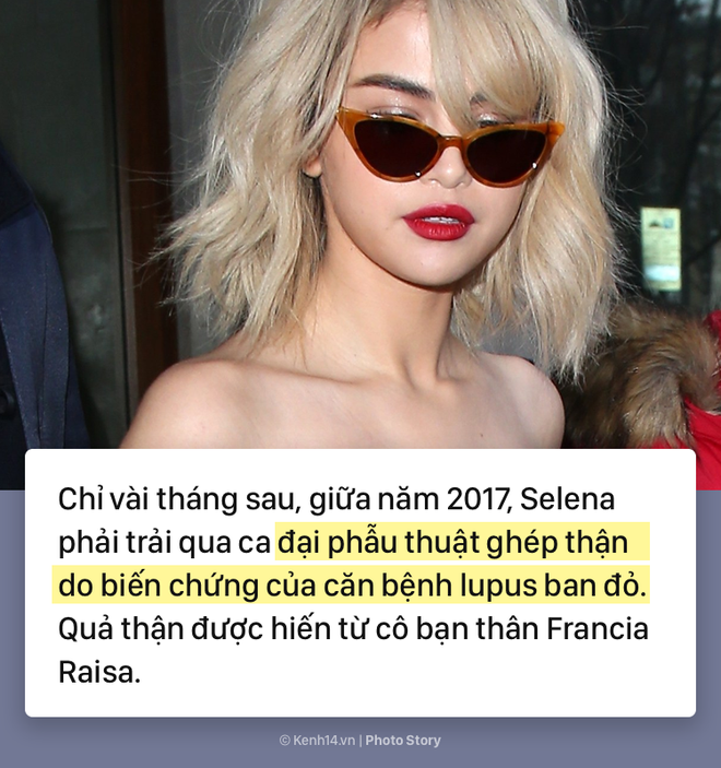 Selena Gomez và hành trình 5 năm chống chọi với căn bệnh lupus ban đỏ kèm di chứng - Ảnh 7.