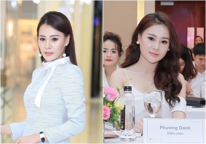 "Quỳnh Búp Bê" Phương Oanh phủ nhận tiêm filler - Ảnh 1.