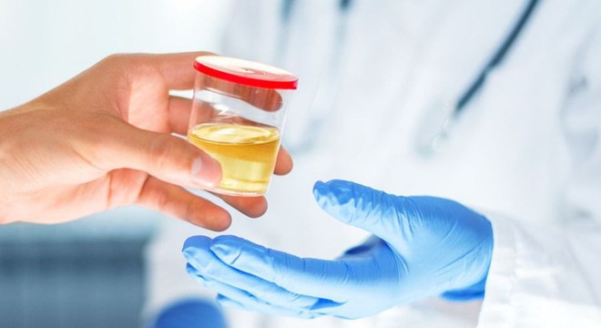 5 dấu hiệu tưởng v&ocirc; hại nhưng lại ngầm cảnh b&aacute;o bệnh ung thư tuyến tiền liệt - Ảnh 2.