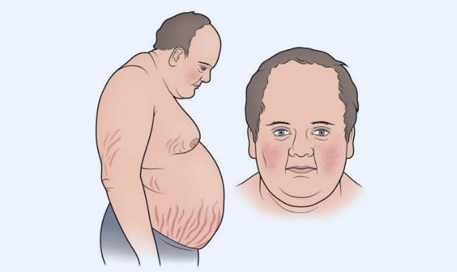 Giảm cân mãi không thành có thể là do bạn đã mắc phải một số căn bệnh tiềm ẩn sau - Ảnh 6.