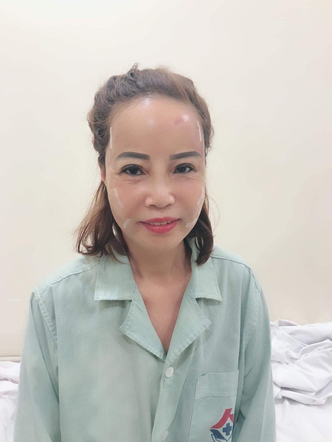 Cô dâu 62 tuổi Thu Sao khoe nhan sắc trẻ trung sau phẫu thuật thẩm mỹ - ảnh 2