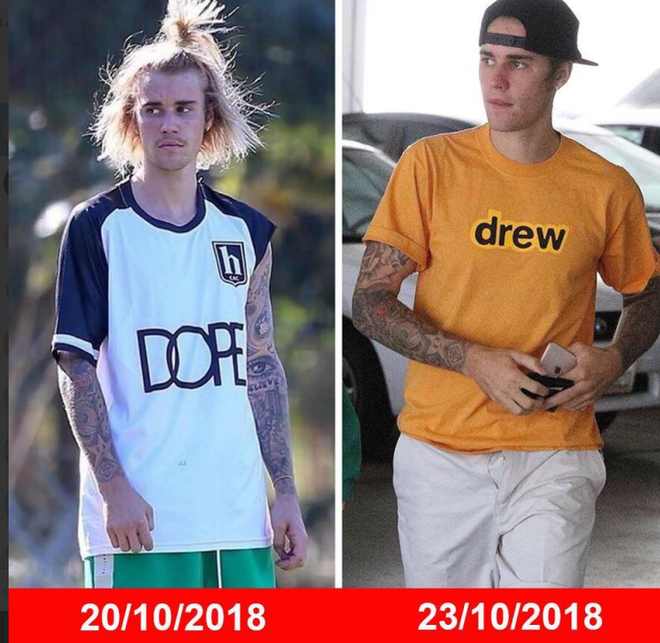 Justin Bieber đã trở lại: sạch sẽ, bảnh bao, mỗi tội quên kéo khoá quần - Ảnh 1.