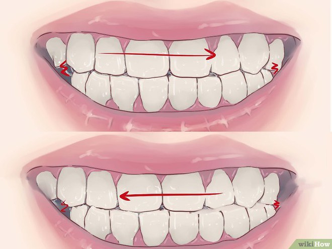 5 triệu chứng bất thường khi ngủ cảnh báo những căn bệnh nguy hiểm mà bạn tuyệt đối không nên chủ quan bỏ qua - Ảnh 2.