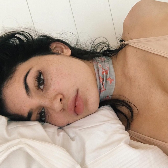 Mơ ước có làn da đẹp như Kylie Jenner không còn xa vời bởi cô nàng đang rục rịch sản xuất đồ dưỡng da rồi! - Ảnh 3.