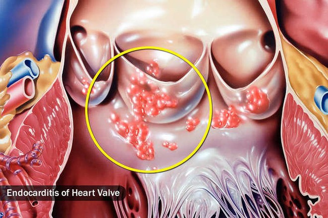 Đổ mồ hôi vào ban đêm có đáng lo ngại? - Ảnh 10.