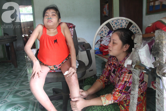 Ph&eacute;p m&agrave;u đến với c&ocirc; g&aacute;i trẻ 12 năm ngủ ngồi, chỉ mong chết đi cho gia đ&igrave;nh bớt khổ - Ảnh 1.