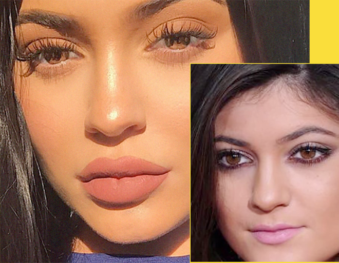 Kylie Jenner khoe môi mỏng dính lạ lẫm trên phố và úp mở đã kết hôn với bạn trai rapper - Ảnh 3.