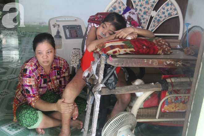 Ph&eacute;p m&agrave;u đến với c&ocirc; g&aacute;i trẻ 12 năm ngủ ngồi, chỉ mong chết đi cho gia đ&igrave;nh bớt khổ - Ảnh 5.