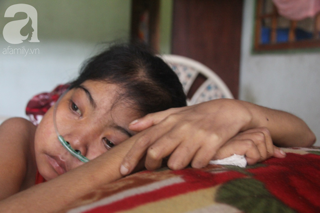 Ph&eacute;p m&agrave;u đến với c&ocirc; g&aacute;i trẻ 12 năm ngủ ngồi, chỉ mong chết đi cho gia đ&igrave;nh bớt khổ - Ảnh 7.