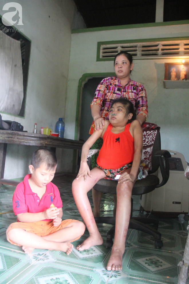 Ph&eacute;p m&agrave;u đến với c&ocirc; g&aacute;i trẻ 12 năm ngủ ngồi, chỉ mong chết đi cho gia đ&igrave;nh bớt khổ - Ảnh 9.