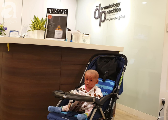 H&igrave;nh ảnh mới nhất của b&eacute; B&iacute;ch bị bỏ rơi, người đầy vẩy ngứa như da trăn sau đợt kh&aacute;m bệnh đầu ti&ecirc;n tại Singapore - Ảnh 1.