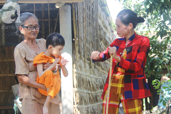 Bố bỏ từ khi chưa sinh ra, bé gái 5 tuổi bại não sống cùng người mẹ tật nguyền cầu xin một lần được chữa bệnh - Ảnh 8.