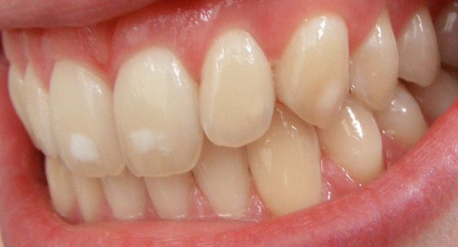 Những dấu hiệu kh&aacute;c lạ tr&ecirc;n cơ thể tưởng rất b&igrave;nh thường nhưng lại tiềm ẩn h&agrave;ng loạt nguy cơ g&acirc;y hại sức khỏe - Ảnh 1.