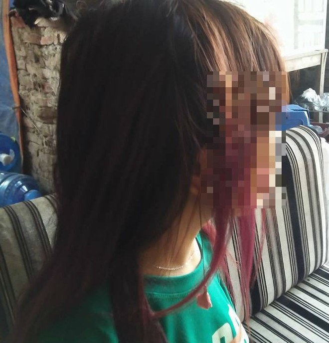 B&aacute;n trứng xuy&ecirc;n bi&ecirc;n giới: G&oacute;c khuất sau những hợp đồng kh&ocirc;ng văn tự - Ảnh 1.