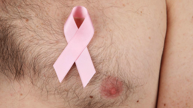 Nhiều người cứ hiểu lầm ngây ngô thế này về ung thư vú nên mắc bệnh mà không hề hay biết - Ảnh 1.