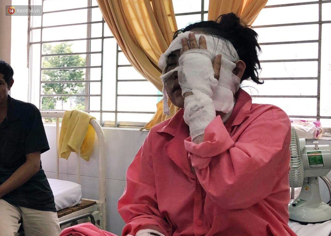 Cô gái sắp cưới bị tạt axit hỏng 2 mắt ở Sài Gòn: “Tôi đau đớn lắm, có thể đám cưới sẽ phải dời lại để lo chữa trị” - Ảnh 1.