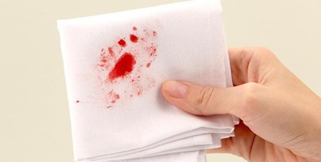 Chảy máu bất thường trên cơ thể: dấu hiệu cảnh báo sức khoẻ bạn không nên xem thường - Ảnh 3.
