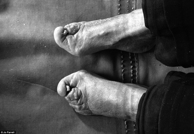 Những đôi chân gót sen cuối cùng tại Trung Quốc: Khi sắc đẹp là nỗi đau suốt đời của người phụ nữ - Ảnh 8.