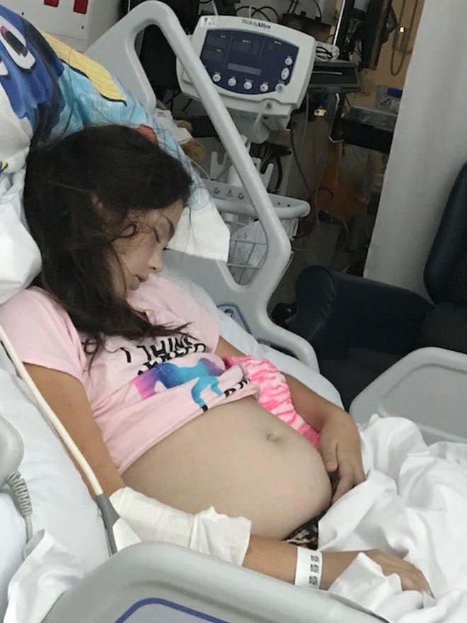 Cô bé 11 tuổi bị lầm tưởng là mang thai nhưng hoá ra lại mang trong mình khối u nguy hiểm - Ảnh 2.