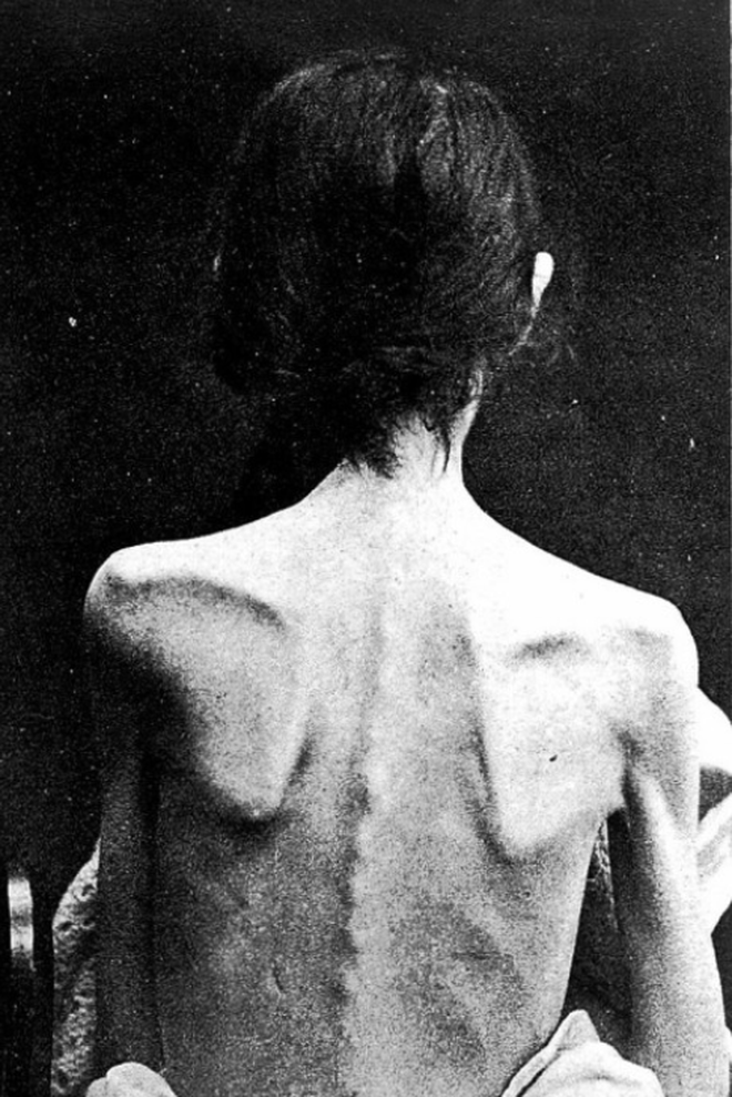 Những hình ảnh rùng rợn tại một trại thương điên thế kỷ 19 ở Pháp, nơi mà phần lớn bệnh nhân bị chữa trị... nhầm bệnh Photo-1-1521299679055856750279