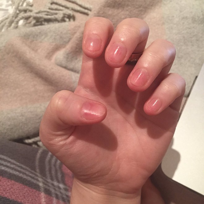 Đi l&agrave;m m&oacute;ng gel nhưng lại th&aacute;o kh&ocirc;ng đ&uacute;ng c&aacute;ch, c&ocirc; g&aacute;i n&agrave;y lập tức ăn quả đắng - Ảnh 5.