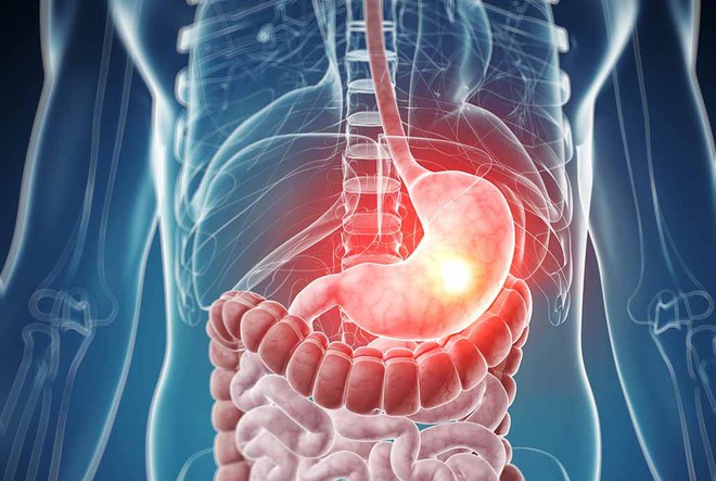 Người Việt cứ giữ th&oacute;i quen ăn mặn m&agrave; kh&ocirc;ng biết c&oacute; thể phải đối mặt với h&agrave;ng loạt t&aacute;c hại n&agrave;y - Ảnh 4.