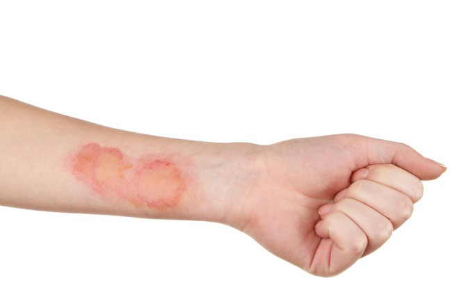 Đừng bỏ qua những dấu hiệu nhỏ này của làn da bởi bạn có thể đang gặp vấn đề nghiêm trọng tới sức khỏe - Ảnh 1.
