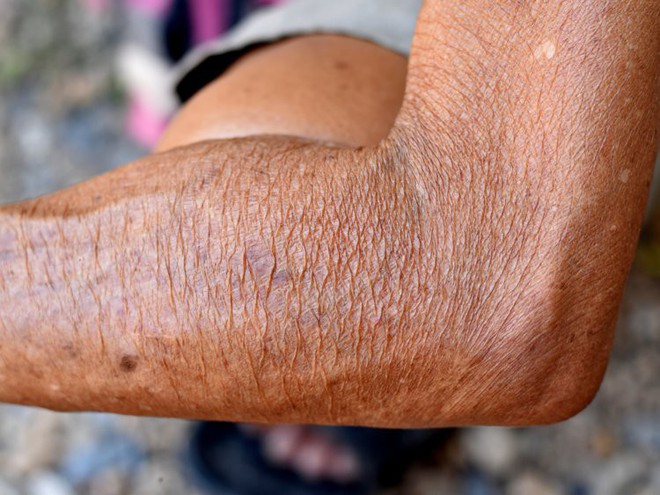 Đừng bỏ qua những dấu hiệu nhỏ này của làn da bởi bạn có thể đang gặp vấn đề nghiêm trọng tới sức khỏe - Ảnh 3.