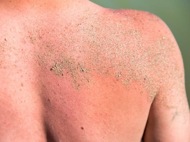 Đừng bỏ qua những dấu hiệu nhỏ này của làn da bởi bạn có thể đang gặp vấn đề nghiêm trọng tới sức khỏe - Ảnh 4.