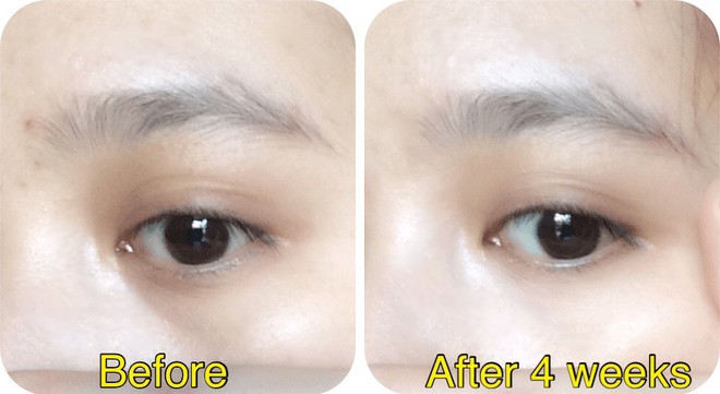 7 kem mắt b&igrave;nh d&acirc;n được c&aacute;c t&iacute;n đồ l&agrave;m đẹp nhắc đến nhiều nhất thời gian qua - Ảnh 4.