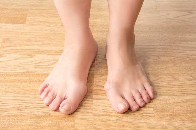 Đôi chân gặp phải 6 dấu hiệu này cảnh báo một loạt căn bệnh đang tiềm ẩn trong cơ thể bạn - Ảnh 5.
