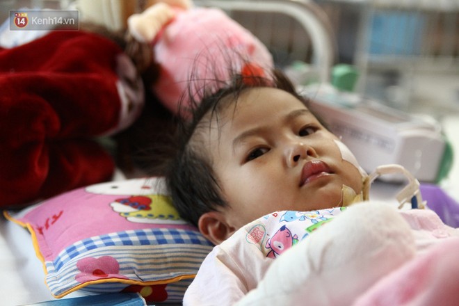 Xót xa bé gái 3 tuổi phải phẫu thuật tháo khớp tứ chi sau cơn sốt nhiễm khuẩn huyết - Ảnh 5.