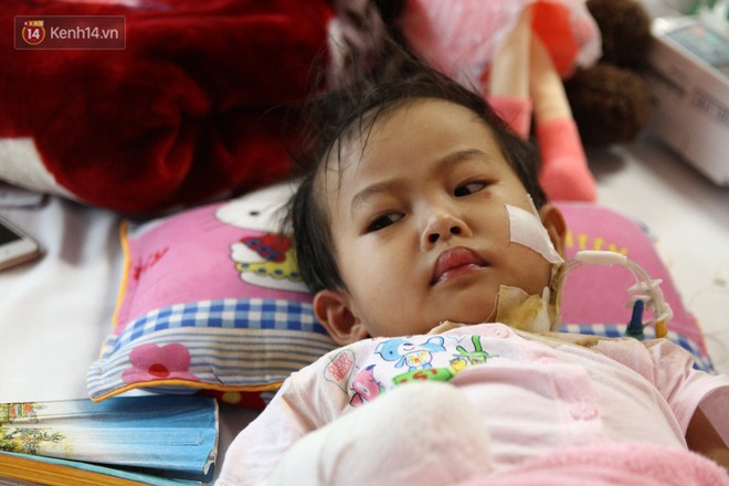 Xót xa bé gái 3 tuổi phải phẫu thuật tháo khớp tứ chi sau cơn sốt nhiễm khuẩn huyết - Ảnh 3.