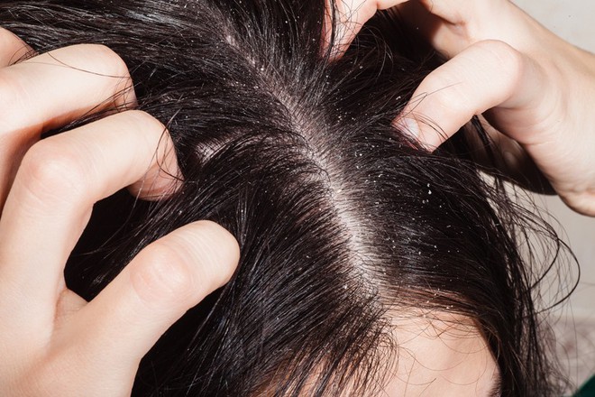 Sử dụng máy tạo kiểu thường xuyên có thể khiến mái tóc gặp phải những vấn đề nghiêm trọng này - Ảnh 4.