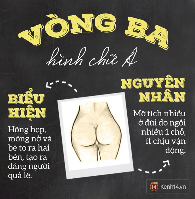 Xác định vòng 3 của mình thuộc kiểu nào để có cách chăm sóc hiệu quả nhất - Ảnh 5.