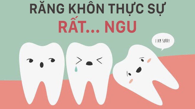 Xem Salim chia sẻ cảm giác khi nhổ răng khôn và những điều cần lưu ý sau khi nhổ  - Ảnh 2.