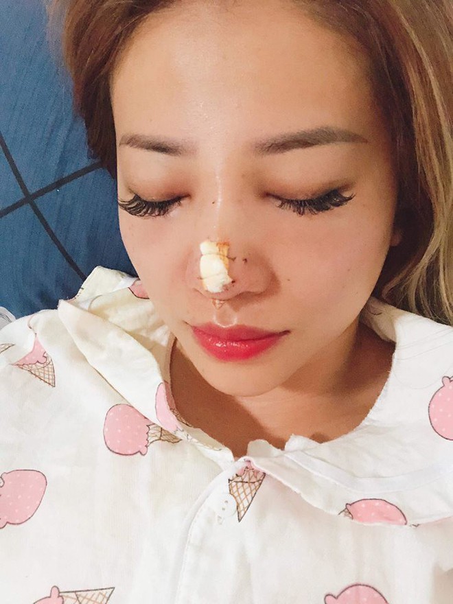 MiA xuất hiện với gương mặt kh&aacute;c lạ, c&ocirc;ng khai h&igrave;nh ảnh phẫu thuật thẩm mỹ - Ảnh 3.