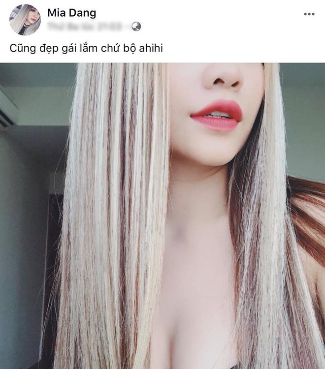 MiA xuất hiện với gương mặt kh&aacute;c lạ, c&ocirc;ng khai h&igrave;nh ảnh phẫu thuật thẩm mỹ - Ảnh 5.