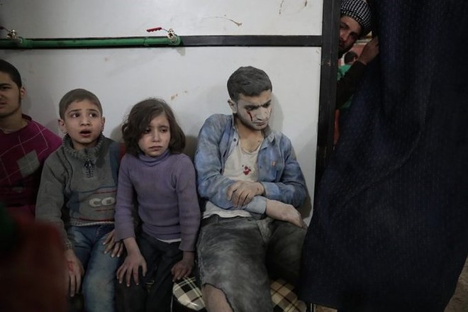 Hình ảnh kinh hoàng được cho là do tấn công hóa học ở Douma (Syria) - Ảnh 7.